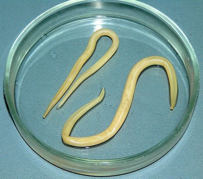 Worm parasites from the human body