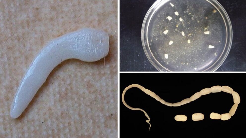 parasites from humans