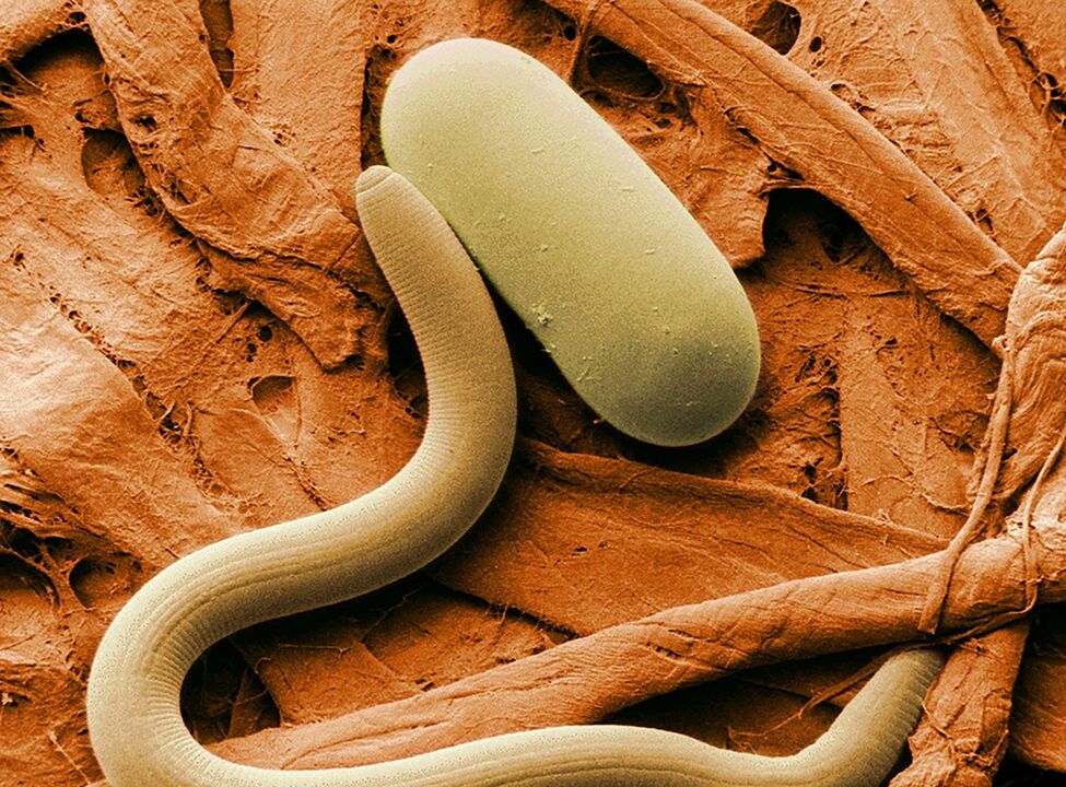 How a worm infection happens