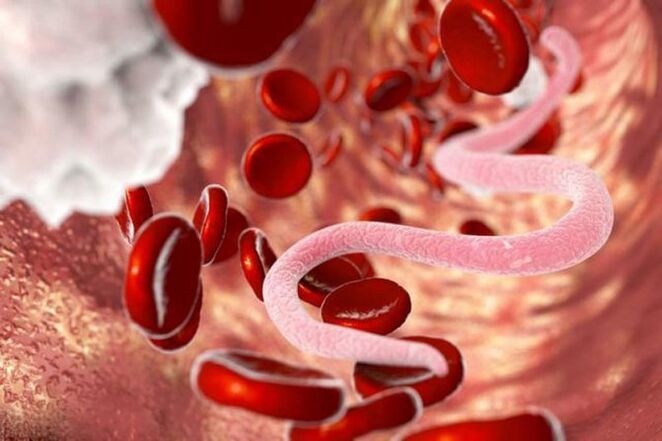 Analysis of worms