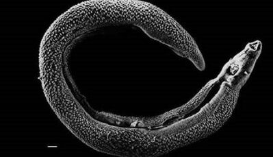 Parasites can live in a person's liver