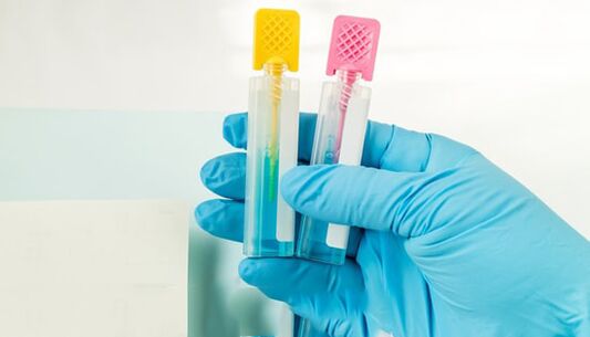 Diagnosis of parasites