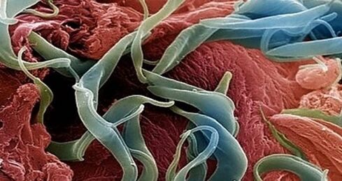 Human parasites photos